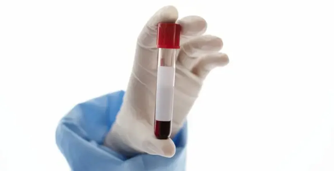 Testemunhas de Jeová flexibilizam regra sobre sangue e reacendem debate médico e religioso